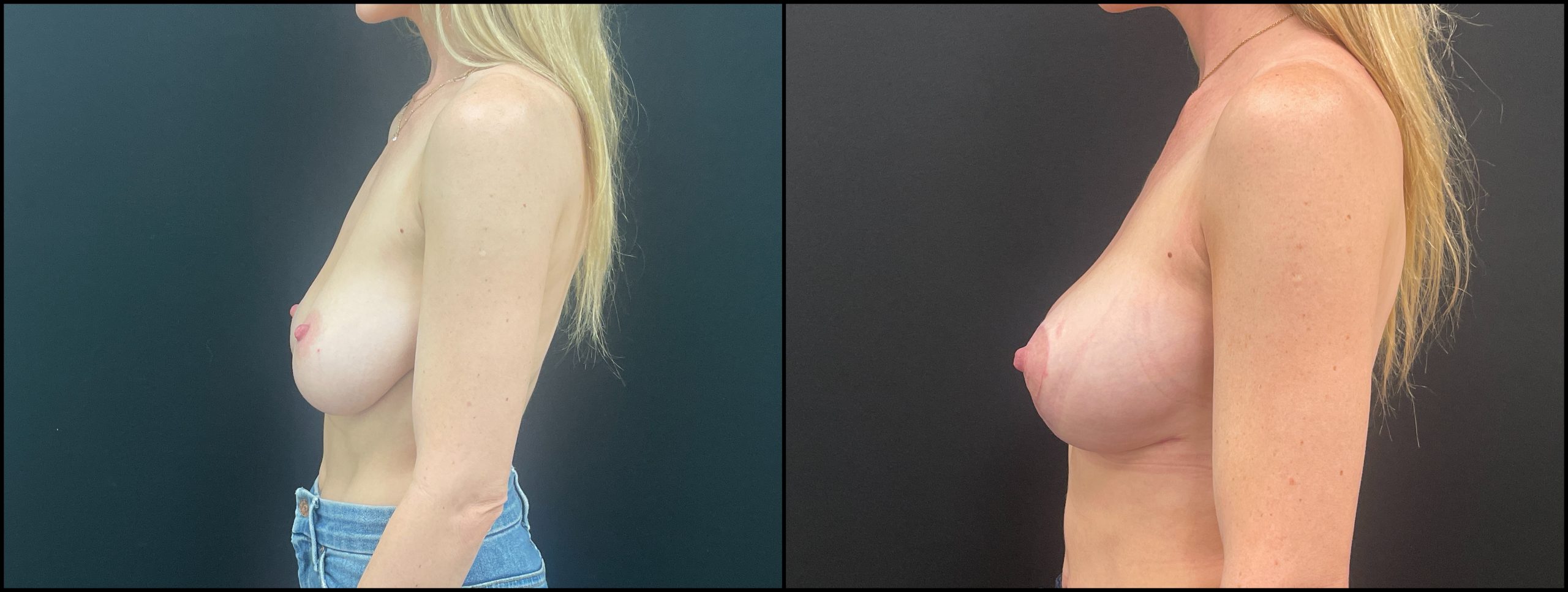 Patient 2