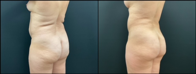 Patient 3