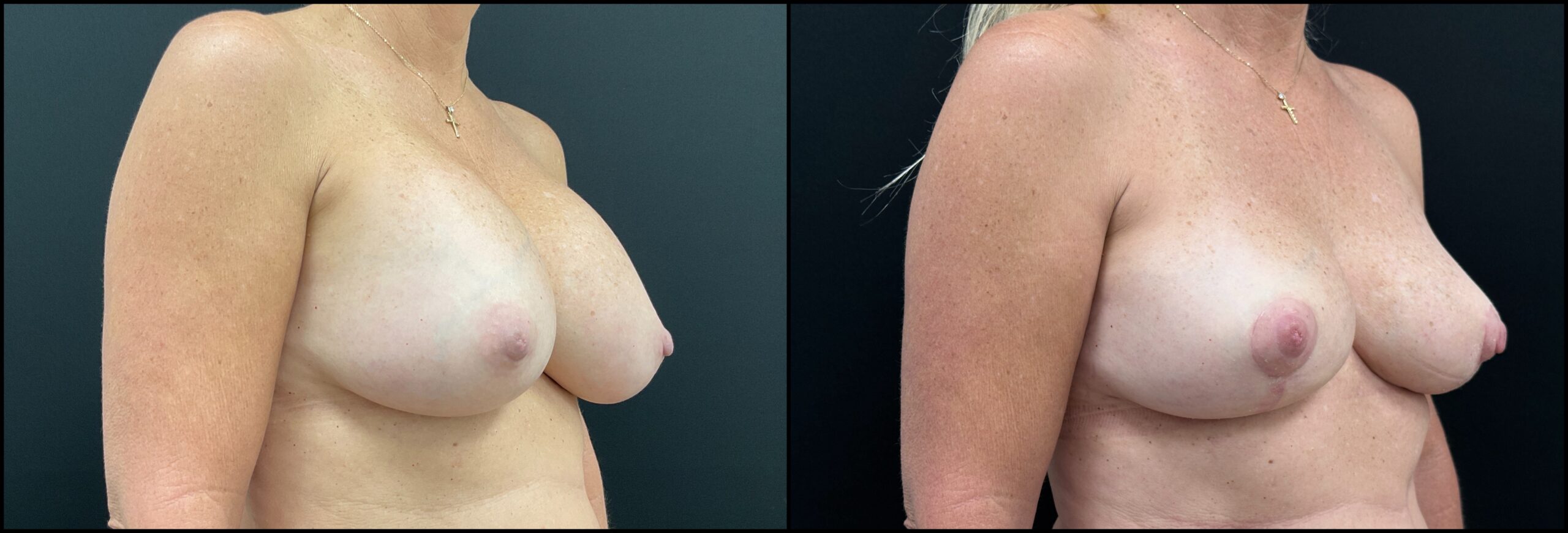 Patient 3
