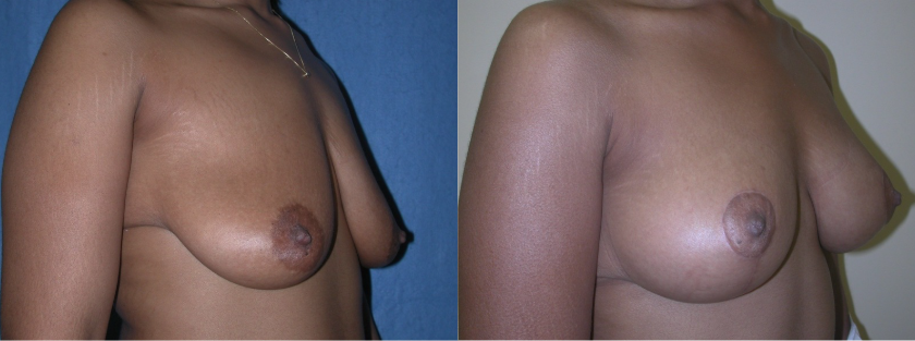 Patient 5